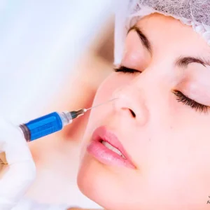 تجميل الأنف